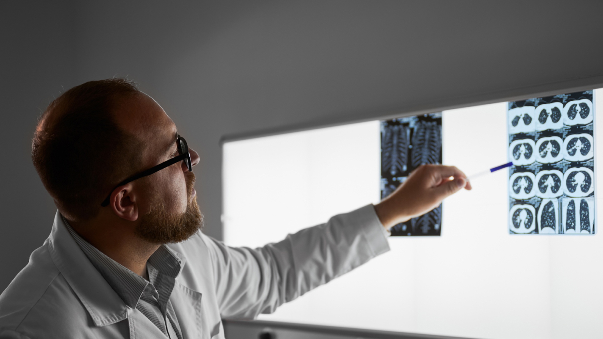 Interstitial Lung Disease