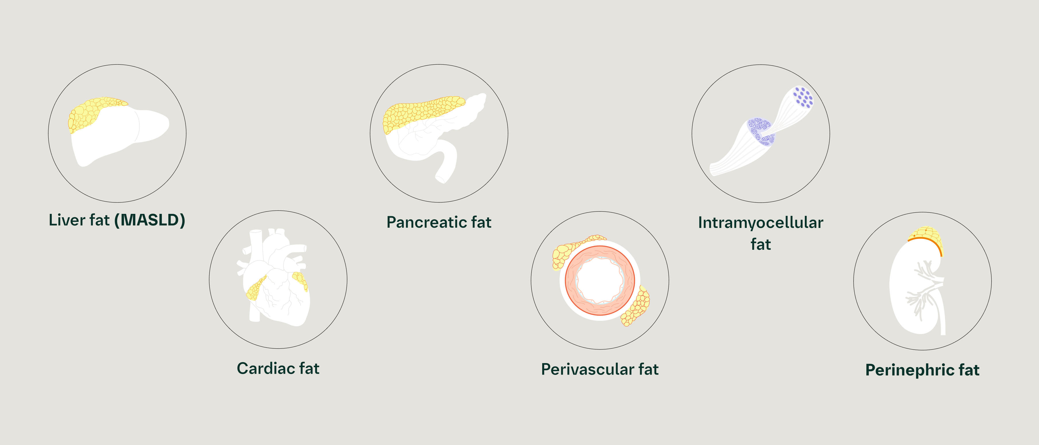 Visceral fat