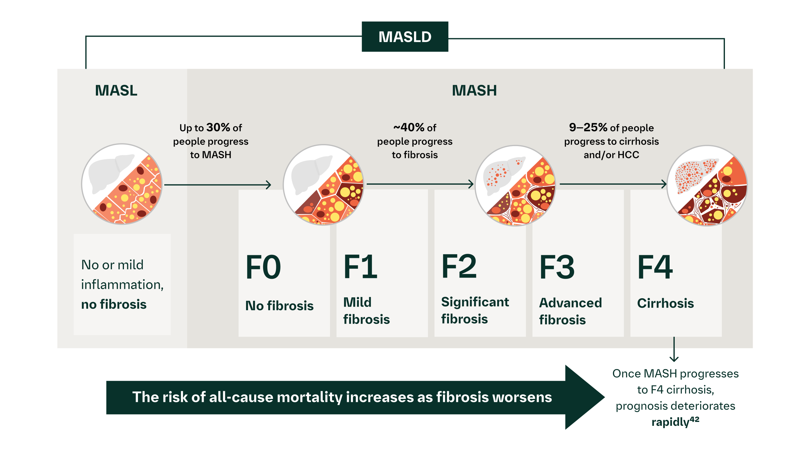 Five stages of liver fibrosis